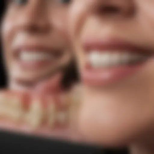 Different types of dental veneers displayed
