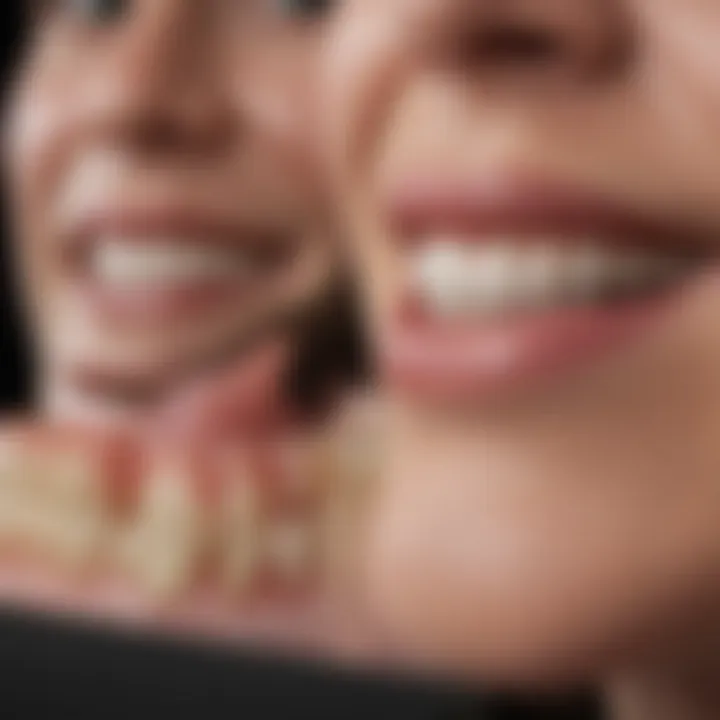 Different types of dental veneers displayed